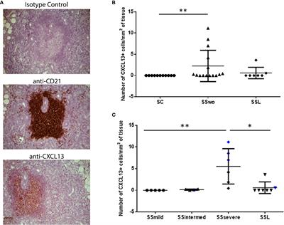 Serum, but Not Saliva, CXCL13 Levels Associate With Infiltrating CXCL13+ Cells in the Minor Salivary Gland Lesions and Other Histologic Parameters in Patients With Sjögren’s Syndrome